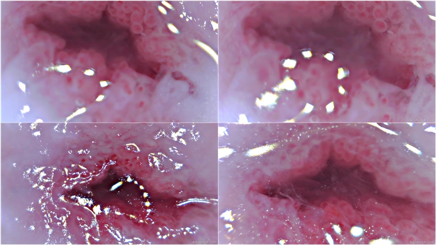 adulting - Cervix Closeup Heartbeat 4K